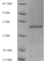 Human papillomavirus type 52 Protein E6 (E6) Recombinant Protein - BioCrest Sci