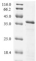 Human HLA class II histocompatibility antigen, DR alpha chain (HLA-DRA), partial Recombinant Protein - BioCrest Sci