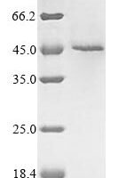 Human Receptor-interacting serine/threonine-protein kinase 1 (RIPK1), partial Recombinant Protein, N-10His/C-Myc, aa 1–375, strain A2 - BioCrest Sci