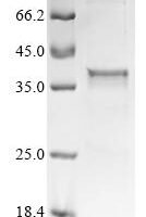 Mouse Ectonucleotide pyrophosphatase/phosphodiesterase family member 1 (Enpp1), partial Recombinant Protein - BioCrest Sci