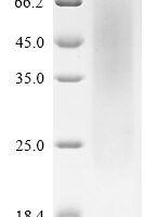 Mouse Latent-transforming growth factor beta-binding protein 4 (Ltbp4), partial Recombinant Protein - BioCrest Sci
