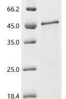 Prunus persica Uncharacterized protein Recombinant Protein, C-His, aa 1–305, E.coli - BioCrest Sci