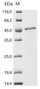 Prunus persica Uncharacterized protein Recombinant Protein, C-His, aa 1–305, E.coli, Prunus persica (Peach) (Amygdalus persica), E.coli, C-terminal 6xHis-tagged, 41.2 kDa, purity >≥ 90% as determined by SDS-PAGE.