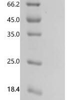 Rat Natriuretic peptides B (Nppb) Recombinant Protein - BioCrest Sci