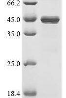 Human Mitotic checkpoint protein BUB3 (BUB3） Recombinant Protein - BioCrest Sci