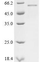 Human Melanoma-associated antigen 2 (MAGEA2; MAGEA2B) Recombinant Protein - BioCrest Sci