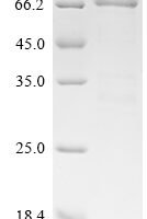 Human adenovirus C serotype 5 E1B 55 kDa protein Recombinant Protein - BioCrest Sci