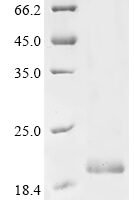Escherichia coli Antitoxin MazE (mazE) Recombinant Protein - BioCrest Sci