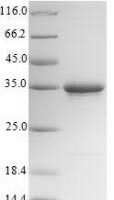 Mouse Collectrin (Cltrn),Partial Recombinant Protein - BioCrest Sci