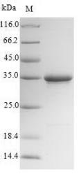 Mouse Collectrin (Cltrn),Partial Recombinant Protein, Mus musculus (Mouse), E.coli, N-terminal 10xHis-SUMO-tagged and C-terminal Myc-tagged, 34.5 kDa, purity >≥ 90% as determined by SDS-PAGE.