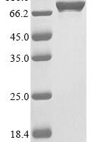 Mouse Cap-specific mRNA (nucleoside-2-O-)-methyltransferase 2 (Cmtr2) Recombinant Protein - BioCrest Sci