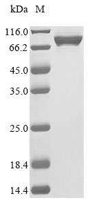 Mouse Cap-specific mRNA (nucleoside-2-O-)-methyltransferase 2 (Cmtr2) Recombinant Protein, Mus musculus (Mouse), E.coli, N-terminal 10xHis-tagged, 90.0 kDa, purity >≥ 85% as determined by SDS-PAGE.
