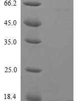 Variola virus Protein OPG154 (OPG154) Recombinant Protein, N-10His - BioCrest Sci