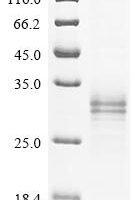 Human Alpha-2A adrenergic receptor (ADRA2A), partial Recombinant Protein, C-His, aa 233–389, Mammalian cell - BioCrest Sci