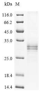 Human Alpha-2A adrenergic receptor (ADRA2A), partial Recombinant Protein, C-His, aa 233–389, Mammalian cell, Homo sapiens (Human), Mammalian cell, C-terminal 6xHis-tagged, 18.6 kDa, purity >≥ 85% as determined by SDS-PAGE.