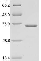Human Alpha-2A adrenergic receptor (ADRA2A), partial Recombinant Protein, C-His, aa 233–389, E.coli - BioCrest Sci