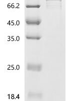Mouse Alanine--tRNA ligase, cytoplasmic (Aars1) Recombinant Protein, C-His, aa 1–968, E.coli - BioCrest Sci