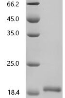 Mouse Neudesin (Nenf) Recombinant Protein, C-His, aa 31–171, Yeast - BioCrest Sci