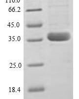 Human C-C motif chemokine 2 (CCL2) Recombinant Protein, N-GST - BioCrest Sci