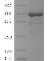 Human High affinity immunoglobulin epsilon receptor subunit alpha (FCER1A), partial Recombinant Protein, N-His - BioCrest Sci