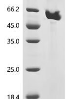 Nepenthes gracilis Aspartic proteinase nepenthesin-2 (nep2) Recombinant Protein, C-10His, aa 25–438, Mammalian cell - BioCrest Sci