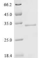 Human Collagen alpha-1 (XXI) chain (COL21A1), Partial Recombinant Protein - BioCrest Sci