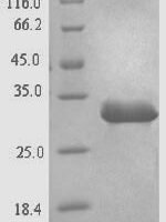 Hepatitis B virus genotype D subtype ayw Protein X (X) Recombinant Protein, N-His-SUMO, aa 1–154, UniProt Q9QMI3 - BioCrest Sci