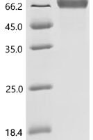 Epstein-Barr virus Glycoprotein 42 (BZLF2), partial Recombinant Protein, C-hFc1 - BioCrest Sci