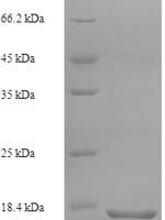 Human Secretory phospholipase A2 receptor (PLA2R1), partial Recombinant Protein, N-His - BioCrest Sci