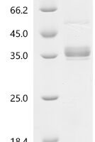 Mouse CD40 ligand (Cd40lg), partial Recombinant Protein - BioCrest Sci