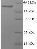 Human Polyadenylate-binding protein 1 (PABPC1), partial Recombinant Protein - BioCrest Sci