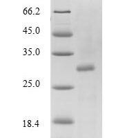 Mouse Transthyretin (Ttr), partial Recombinant Protein, N-His-SUMO - BioCrest Sci