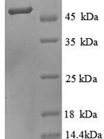 Human O-phosphoseryl-tRNA (Sec) selenium transferase (SEPSECS), partial Recombinant Protein - BioCrest Sci