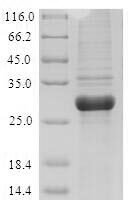 Artemisia vulgaris Major pollen allergen Art v 1 Recombinant Protein - BioCrest Sci