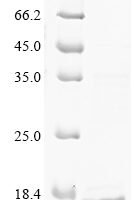 Human CD81 antigen (CD81), partial Recombinant Protein, N-10His/C-Myc - BioCrest Sci