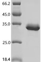 Mouse Filamin-C (Flnc), partial Recombinant Protein, C-His - BioCrest Sci