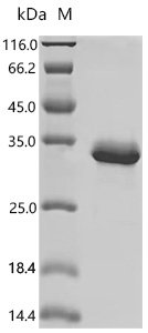 Mouse Filamin-C (Flnc), partial Recombinant Protein, C-His, Mus musculus (Mouse), E.coli, C-terminal 6xHis-tagged, 30.8 kDa, purity >≥ 90% as determined by SDS-PAGE.