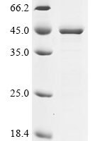 Chlamydophila psittaci Major outer membrane porin (ompA) Recombinant Protein, N-10His/C-Myc - BioCrest Sci