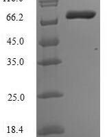 Human Matrix metalloproteinase-14 (MMP14) Recombinant Protein - BioCrest Sci