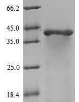 Mouse Guanine nucleotide-binding protein G (o) subunit alpha (Gnao1) Recombinant Protein, N-10His - BioCrest Sci