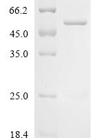 Mouse Protein fosB (Fosb) Recombinant Protein - BioCrest Sci