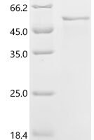 Newcastle disease virus Fusion glycoprotein F0 (F), partial Recombinant Protein, C-His, aa 32–500, strain Her/33 - BioCrest Sci