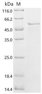 Newcastle disease virus Fusion glycoprotein F0 (F), partial Recombinant Protein, C-His, aa 32–500, strain Her/33, Newcastle disease virus (strain Her/33) (NDV), E.coli, C-terminal 6xHis-tagged, 56.7 kDa, purity >≥ 85% as determined by SDS-PAGE.