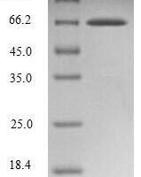 Human Endophilin-B1 (SH3GLB1) Recombinant Protein - BioCrest Sci