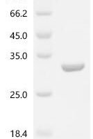 Rat Alpha-crystallin A chain (Cryaa) Recombinant Protein - BioCrest Sci