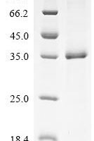Human Granzyme B (GZMB) Recombinant Protein, C-His - BioCrest Sci