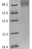 Human CD48 antigen (CD48) Recombinant Protein - BioCrest Sci