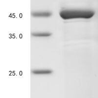 Human Methyl-CpG-binding domain protein 2 (MBD2), partial Recombinant Protein, N-His-KSI - BioCrest Sci