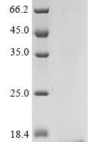 Human C-C motif chemokine 16 (CCL16) Recombinant Protein, N-10His-HA - BioCrest Sci