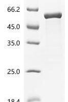 Escherichia coli Autoinducer-2 kinase (lsrK) Recombinant Protein, C-His - BioCrest Sci